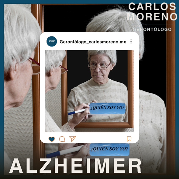 Alzheimer